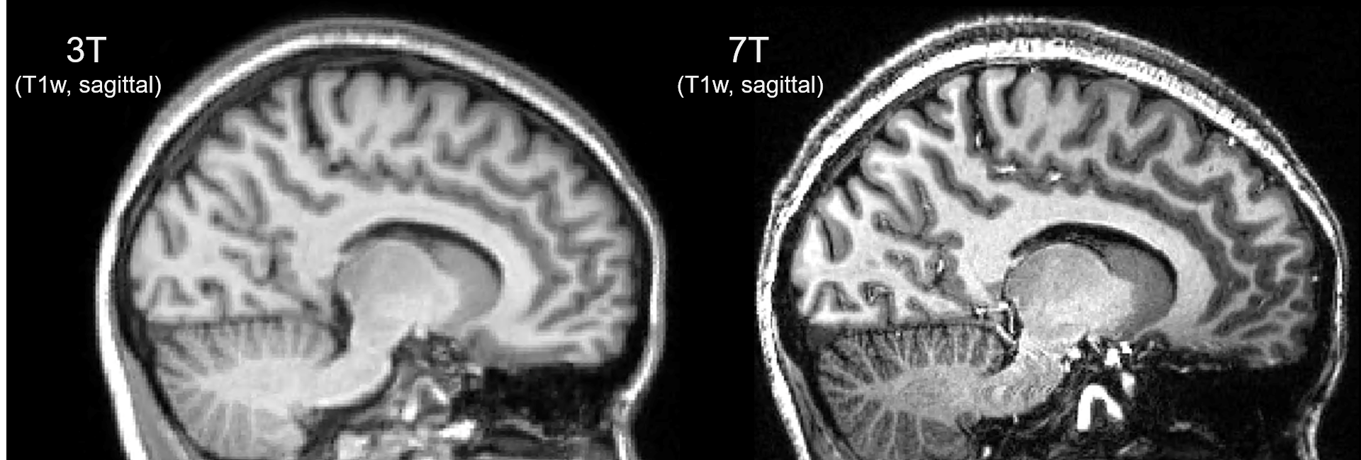 T1_3T7T_sagital