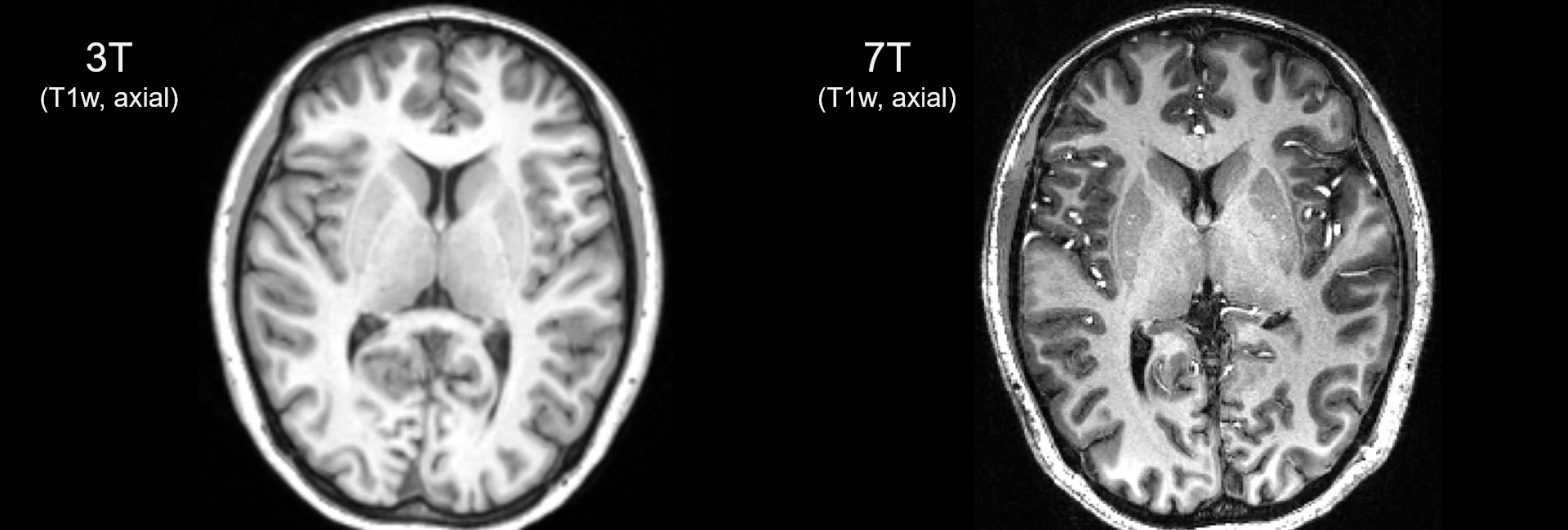 T1_3T7T_axial